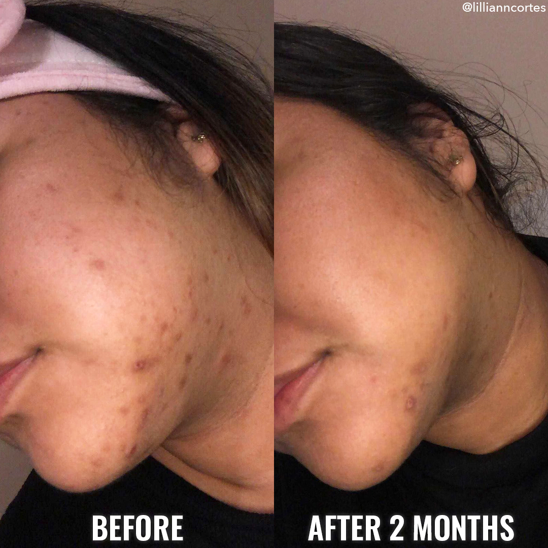 Good Molecules Discoloration Correcting Serum 30ml