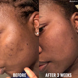 Good Molecules Discoloration Correcting Serum 30ml