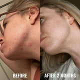 Good Molecules Discoloration Correcting Serum 30ml