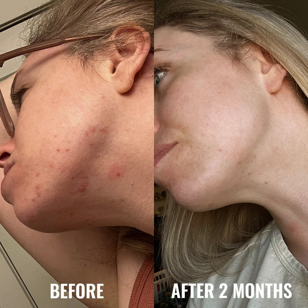 Good Molecules Discoloration Correcting Serum 30ml