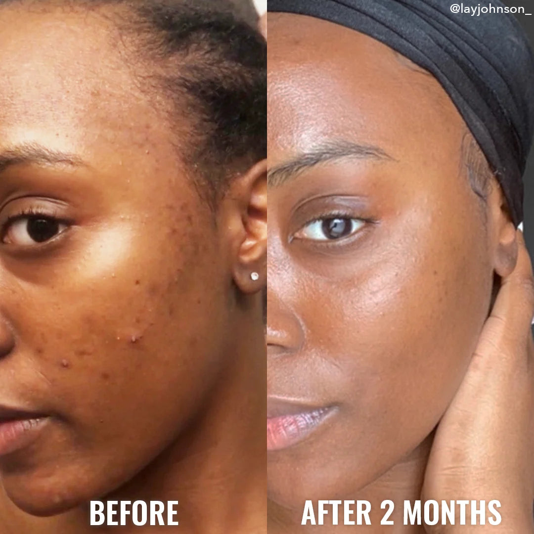 Good Molecules Discoloration Correcting Serum 30ml