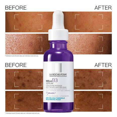 La Roche-Posay Mela B3 Intense Anti-Dark Spot Serum 30ml