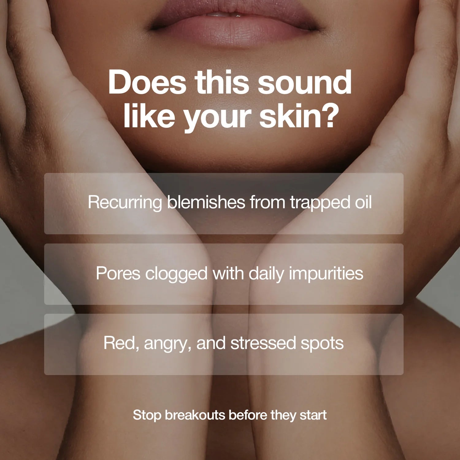 A-Control Heartleaf & BHA Cleanser 120ml