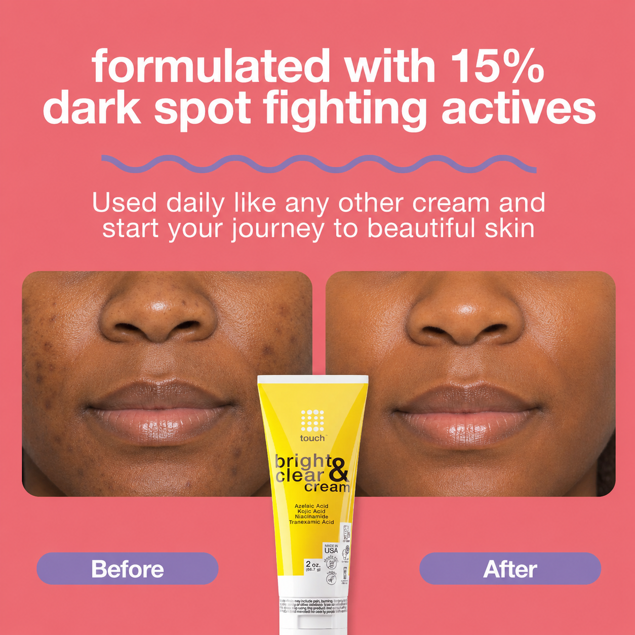 Touch Skincare Bright And Clear Cream 2 Oz /56.7g